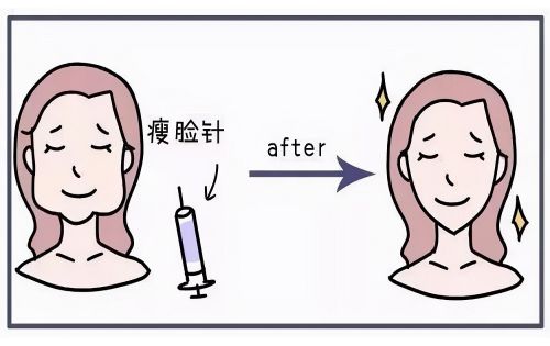西安注射瘦脸医院实力推荐名单：市中心医院、叶子医疗都是相当不错的！