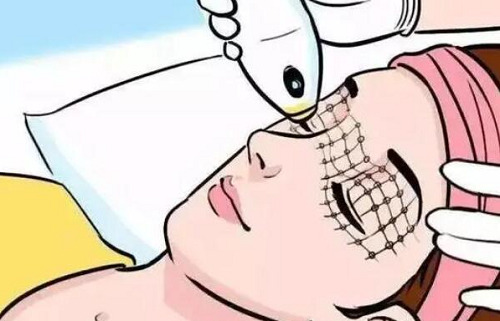 广州曙光整形医院热玛吉怎么样?技术熟练，医生实力在线！