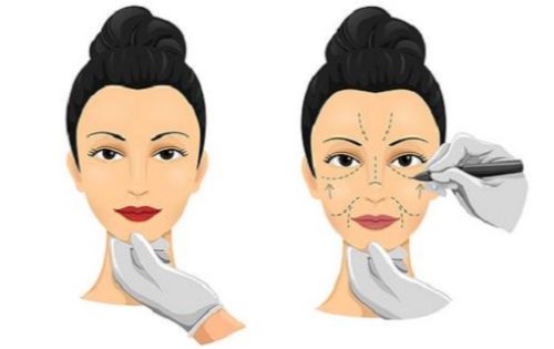 汕头天佑整形医院怎么样？哪些医生技术好？擅长项目有哪些？