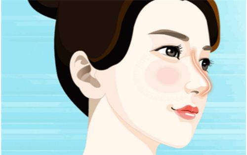 长沙亚韩医学美容医院做隆鼻效果怎么样？技术高超，收费合理！