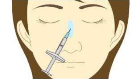 注射隆鼻术的原理是什么？技术优势解析