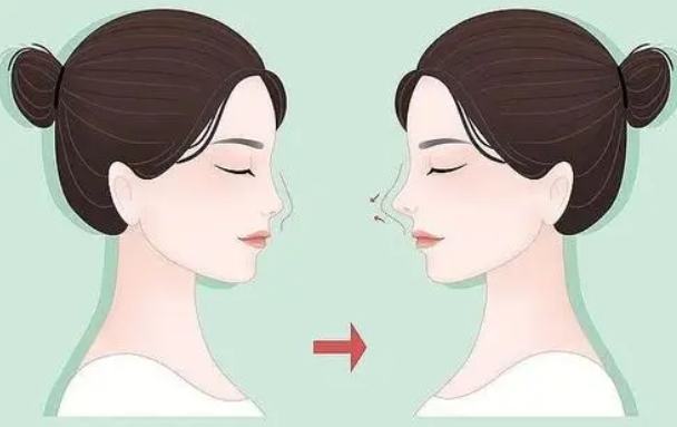 鼻综合后感染的具体症状有哪些?