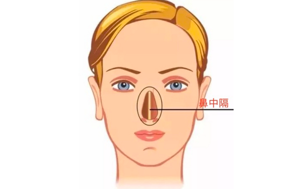 鼻中隔隆鼻是永久的吗?有什么后遗症?