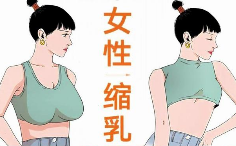 乳房缩小手术：重塑自信，迎接健康生活的优势