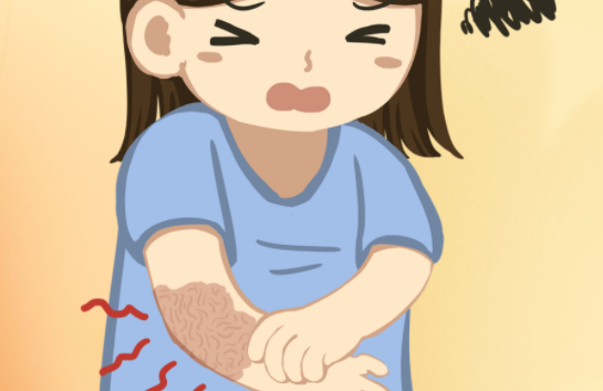 受伤后疤痕总凸起?4 步自测是否为疤痕增生体质