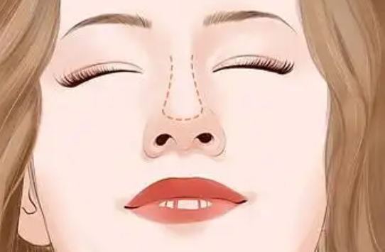 常见的隆鼻方法有几种?一起来看看吧