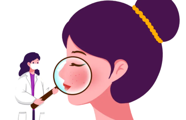 激光调节红血丝，这些危害你了解吗?