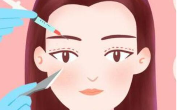 双眼皮手术后肉条感需要多久才能消失?