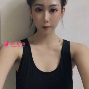 分享成都美莱医院吴江山为我做的假体隆胸，从A到C的经历