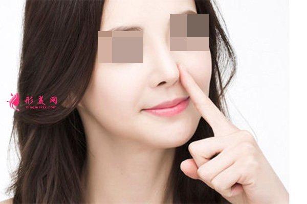 假体隆鼻效果好不好