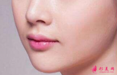 鼻翼缩小手术的效果怎样？