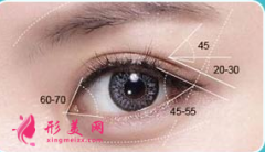 开眼角哪里做得比较好？