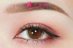 开眼角的效果好看吗？