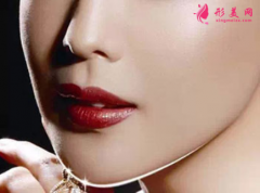 假体垫下巴的效果好看吗？