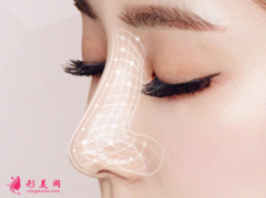 硅胶隆鼻和膨体隆鼻哪个好？