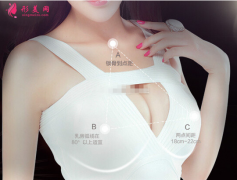 假体隆胸术后会不会有副作用
