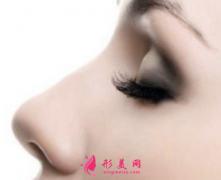 假体隆鼻后会移动吗？