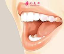 牙齿隐形矫正过程痛吗？