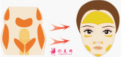 自体脂肪填充脸部脂肪存活率跟什么有关？