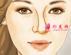 假体隆鼻歪斜了还能矫正吗？