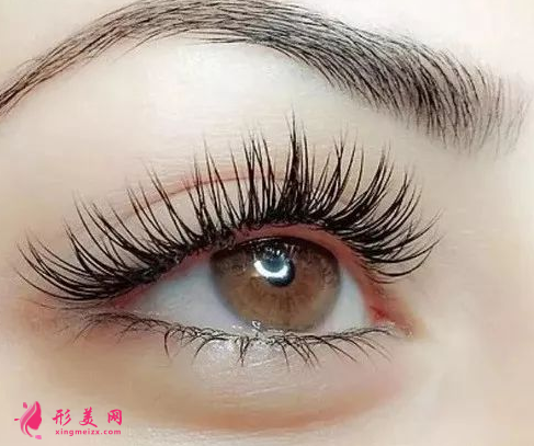 开眼角手术什么时候能拆线