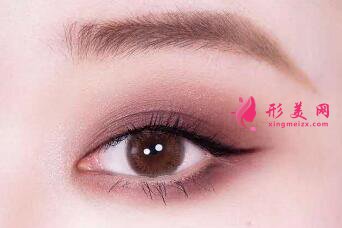 开眼角术后的效果明显吗