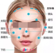 自体脂肪填充脸部效果自然吗？