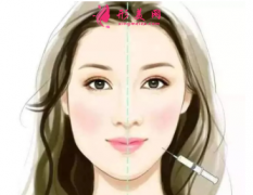 瘦脸针打了有用吗？