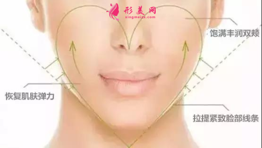 自体脂肪填充脸部后可以保持多久