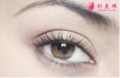 一般全切双眼皮要多少钱?双眼皮全切的优势分析