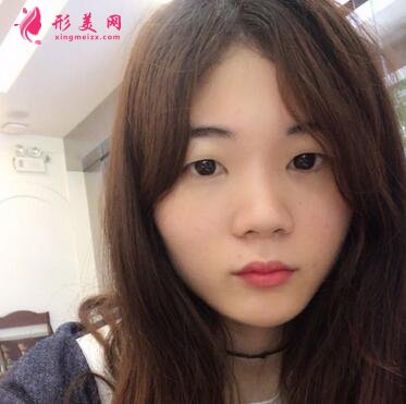 浙江省中医院整形科去眼袋怎么样?价格表|简介|案例效果多图反馈