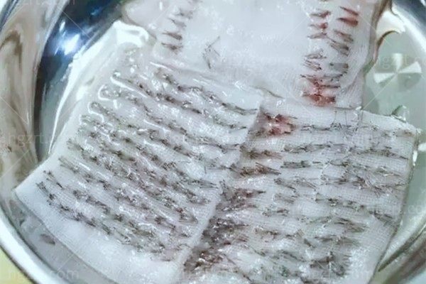 深圳植发价格表查询,解答除了植发费用,植发前检查是免费的吗?