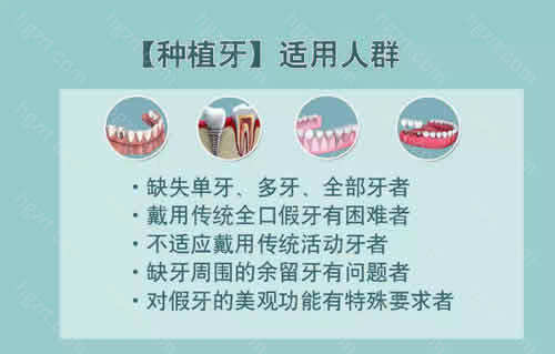 成都种植牙一颗多少钱？内附十大种植体品牌及价格