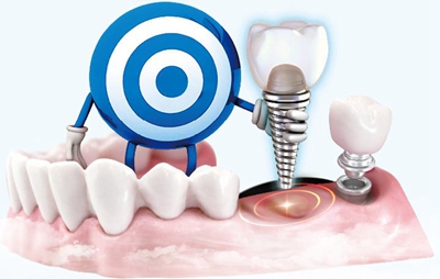 西安牙科医院牙齿种植多少钱 中诺口腔实力雄厚 价格公道