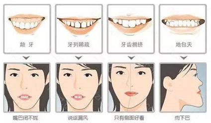 牙齿矫正大概要花多少钱？牙齿矫正可以分期吗？