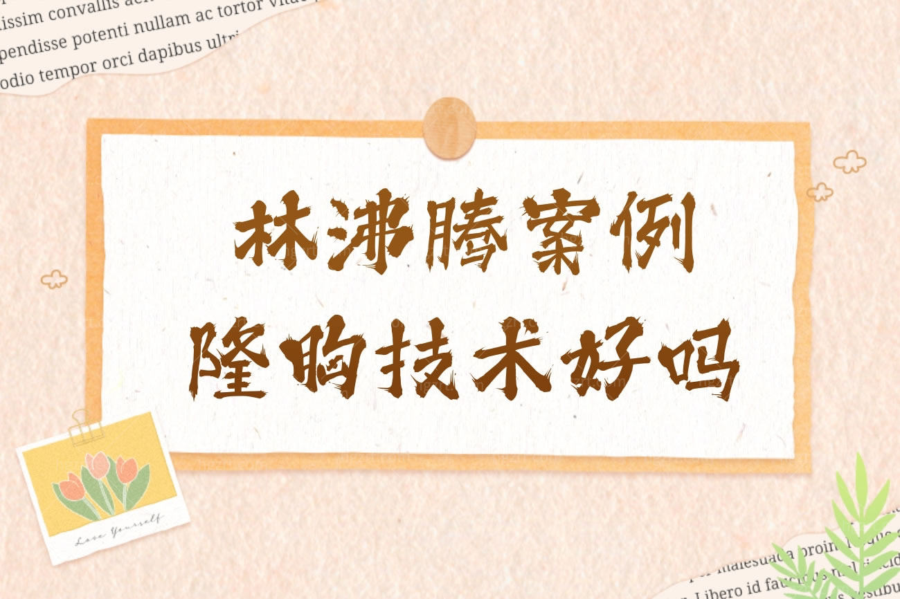 林沸腾案例隆胸技术好吗?福州海峡美容医院怎么样正规吗