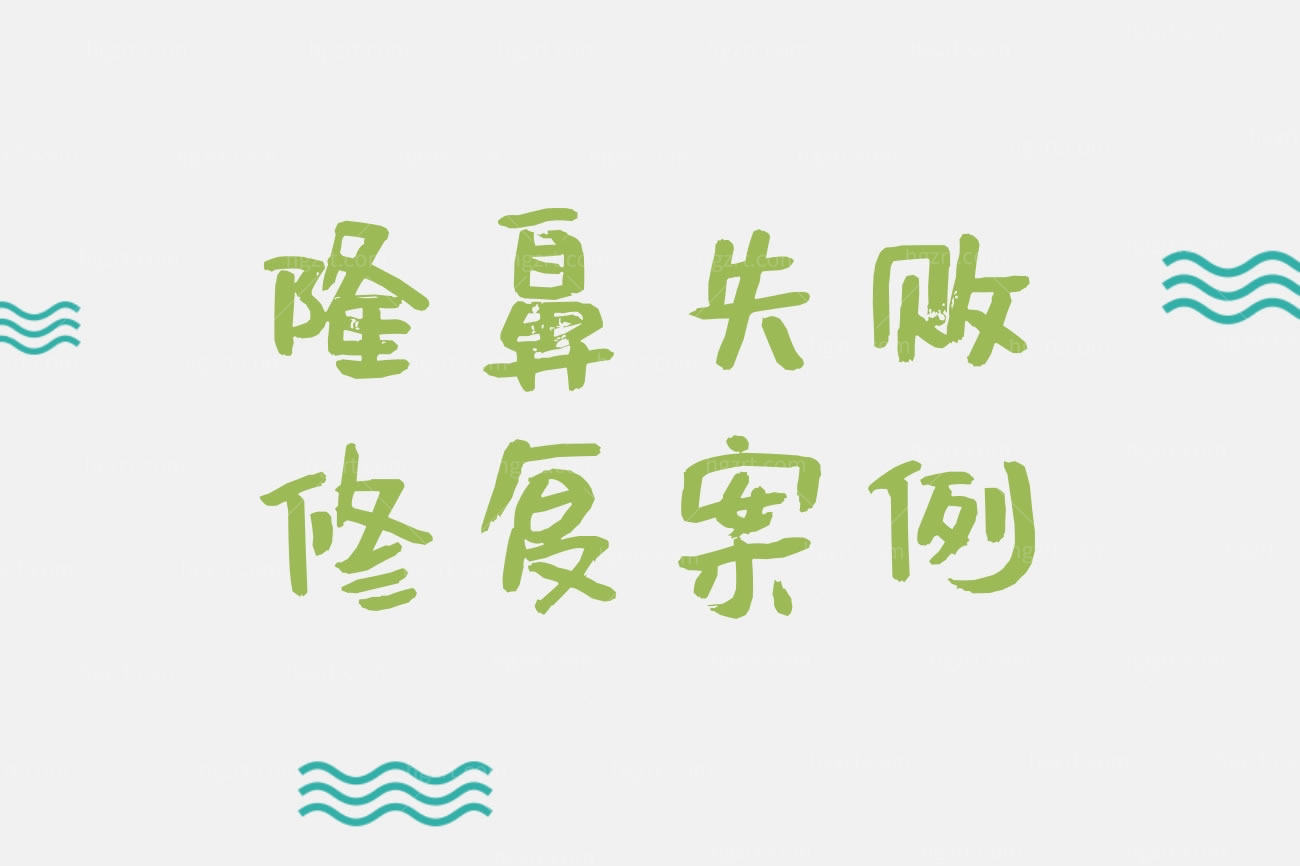 隆鼻失败修复案例,针对各种修复情况选择对应的修复方式