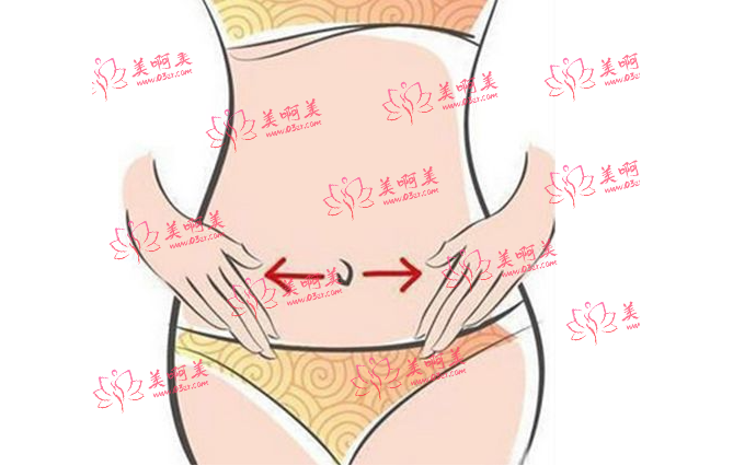 2023全身各部位吸脂手术最新价格表,吸脂手术的定价方式是？