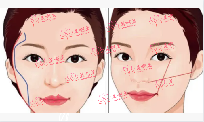 上海九院整形资质介绍！颧骨整形项目很热门！地址、挂号攻略分享！